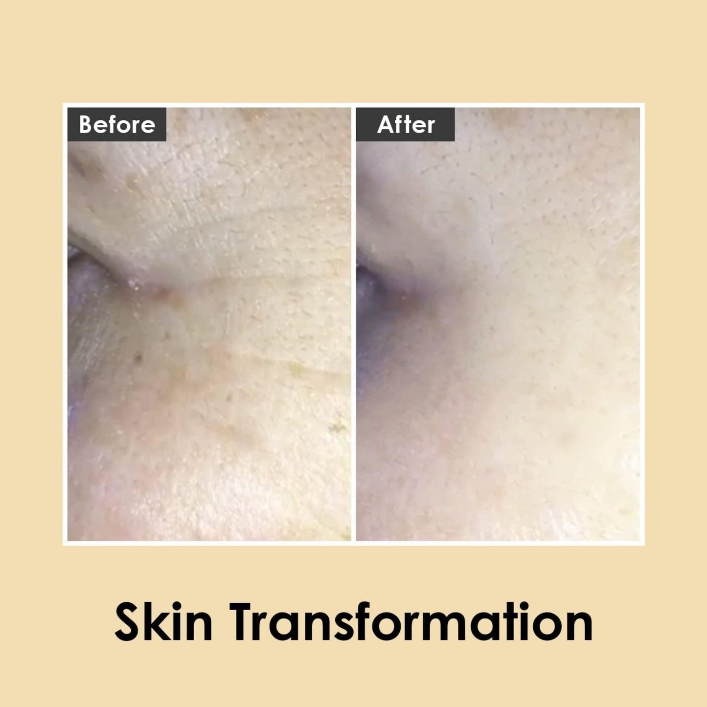 Crema de ochi MEDIPEEL Peptide 9 Hyaluronic Volumy, cu peptide si acid hialuronic, pentru zona ochilor, efect de lifting si hidratare intensa.