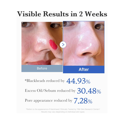 Medicube Zero Pore Pad 70 buc dischete exfoliante rezultate vizibile