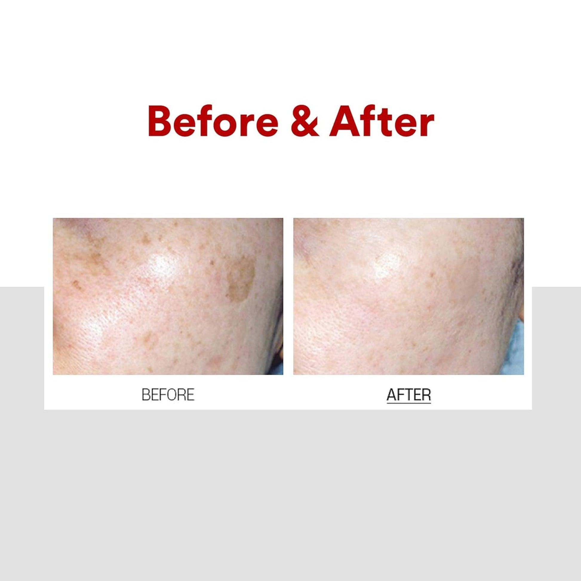 Crema fata pentru pete pigmentare cu vitamina C si niacinamida, pentru ten neuniform, 30 ml