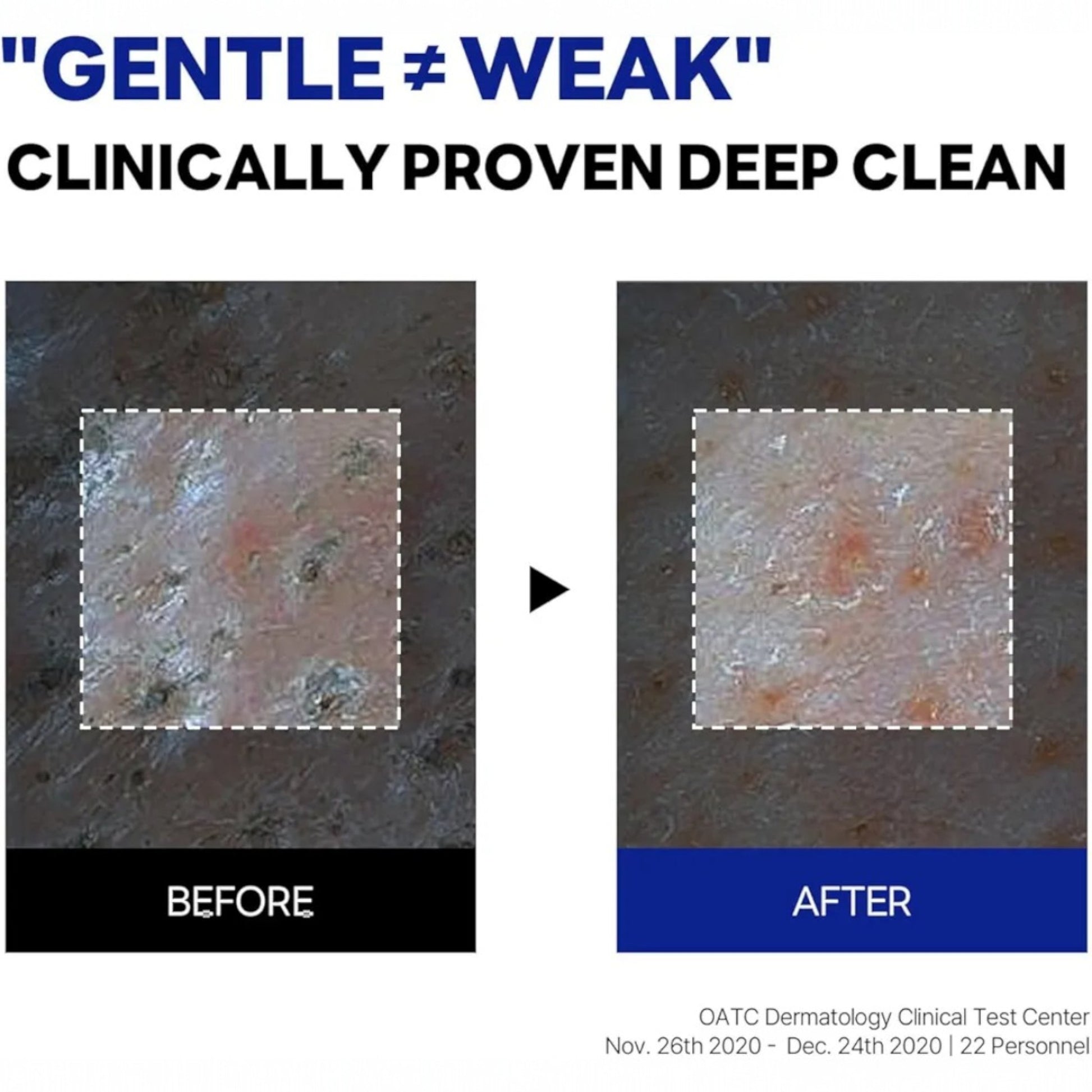 ROUND LAB Birch Juice Moisturizing Cleanser, gel de curățare hidratant care lasă pielea curată și revigorată